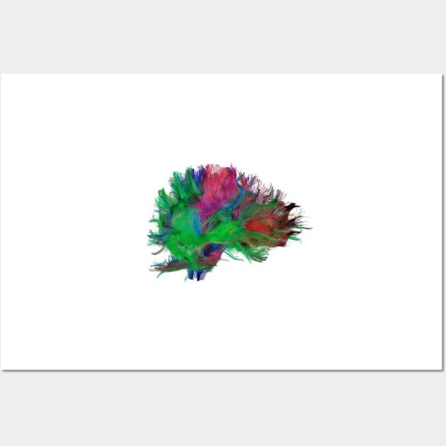 Brain fibres side view right, DTI scan (C038/4665) Wall Art by SciencePhoto